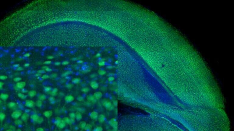 NeuN antibody ab177487 (green) and DAPI (blue) used with Tissue Clearing Kit ab243298 to clear and stain a 1 mm thick coronal section of mouse brain.